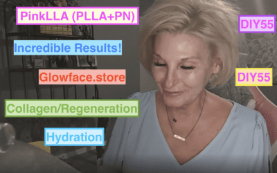 Incredible Results with New Biostimulator PinkLLA